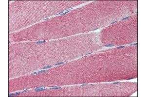 Immunohistochemistry: Human Skeletal Muscle: Formalin-Fixed, Paraffin-Embedded (FFPE). (Cell Adhesion Molecule 4 anticorps  (Internal Region))