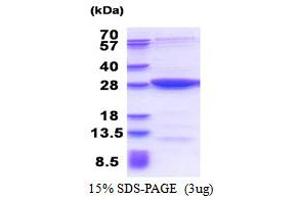 SDS-PAGE (SDS) image for MOB Kinase Activator 3B (MOB3B) (AA 1-216) protein (His tag) (ABIN5853502)