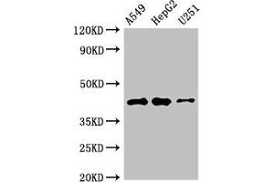 Western Blot Positive WB detected in: A549 whole cell lysate, HepG2 whole cell lysate, U251 whole cell lysate All lanes: B4GALT2 antibody at 3. (B4GALT2 anticorps  (AA 271-372))
