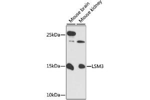 Western blot analysis of extracts of various cell lines, using LSM3 antibody (ABIN6292511) at 1:3000 dilution. (LSM3 anticorps)