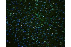 IF analysis of TPR using anti-TPR antibody (ABIN5693275) TPR was detected in paraffin-embedded section of mouse brain tissues. (TPR anticorps)