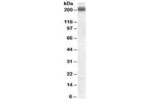 Western blot testing of Daudi cell lysate with CD45RB antibody (clone PD7/26).