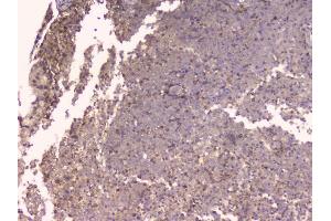 IHC analysis of TNFRSF11B using anti-TNFRSF11B antibody (ABIN7600875).