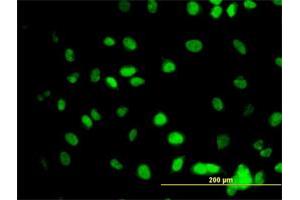 Immunofluorescence of monoclonal antibody to GATA2 on HeLa cell. (GATA2 anticorps  (AA 1-102))