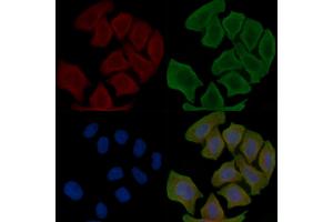 ABIN6266215 and ABIN6277373 staining Hela cells(30 min of UV treatment) by IF/ICC. (Connexin 31 anticorps  (C-Term))