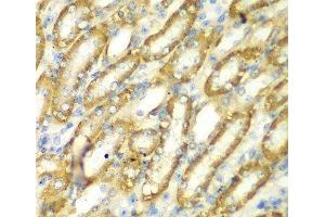 Immunohistochemistry of paraffin-embedded Mouse kidney using TM9SF1 Polyclonal Antibody at dilution of 1:100 (40x lens). (TM9SF1 anticorps)