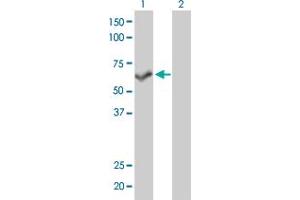 Western Blot analysis of PPP3CB expression in transfected 293T cell line by PPP3CB monoclonal antibody (M01), clone 5D3.