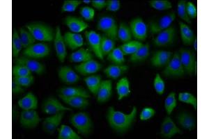 Immunofluorescence staining of A549 cells with ABIN7157022 at 1:166, counter-stained with DAPI.