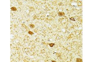 Immunohistochemistry of paraffin-embedded Mouse brain using PVALB Polyclonal Antibody at dilution of 1:100 (40x lens). (PVALB anticorps)