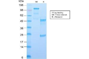 SDS-PAGE Analysis Purified CD34 Recombinant Rabbit Monoclonal Antibody (HPCA1/2598R).