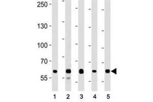 FOXP1 antibody western blot analysis in (1) A549, (2) Daudi, (3) Jurkat, (4) MCF-7, and (5) NCI-H292 lysate