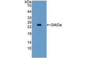 Western blot analysis of recombinant Rat GPX5. (GPX5 anticorps  (AA 22-221))