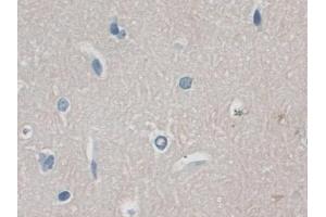 Detection of RANk in Mouse Cerebrum Tissue using Polyclonal Antibody to Receptor Activator Of Nuclear Factor Kappa B (RANk)