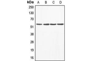 Western blot analysis of ABI1 expression in A549 (A), MCF7 (B), mouse liver (C), rat heart (D) whole cell lysates. (ABI1 anticorps  (Center))