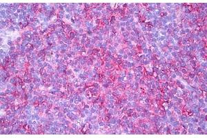 Anti-HLA-DR antibody IHC staining of human thymus, medulla. (HLA-DR anticorps)