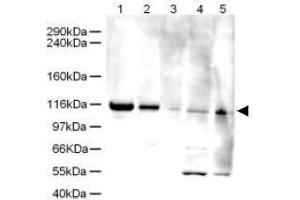 Image no. 1 for anti-ATPase Family, AAA Domain Containing 5 (ATAD5) (AA 63-76) antibody (ABIN401276) (ATAD5 anticorps  (AA 63-76))