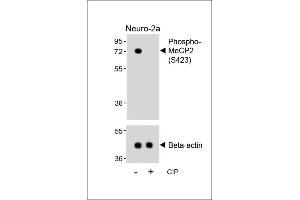 Western blot analysis of lysates from Neuro-2a cell line, untreated or treated with calf intestinal alkaline phosphatase(CIP), using Phospho-MeCP2 Antibody (upper) or Beta-actin (lower). (MECP2 anticorps  (pSer423))