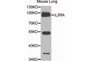 Western blot analysis of extracts of mouse lung cells, using IL3RA antibody. (IL3RA anticorps)