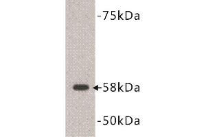 Western Blotting (WB) image for anti-Deoxynucleotidyltransferase, terminal (DNTT) (C-Term) antibody (ABIN1854983) (TdT anticorps  (C-Term))