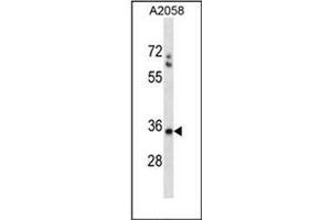 Western blot analysis of SPEM1 Antibody (Center) in A2058 cell line lysates (35ug/lane). (SPEM1 anticorps  (Middle Region))