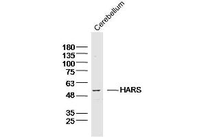 Mouse cerebellum lysates probed with HARS Polyclonal Antibody, Unconjugated  at 1:300 dilution and 4˚C overnight incubation. (HARS1/Jo-1 anticorps  (AA 21-120))