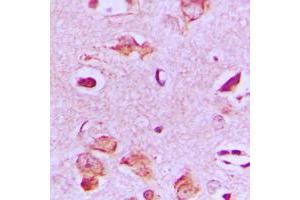 Immunohistochemical analysis of MAST4 staining in human brain formalin fixed paraffin embedded tissue section. (MAST4 anticorps  (N-Term))