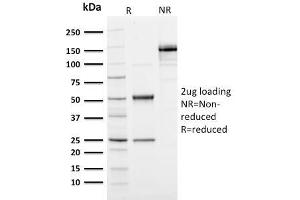 SDS-PAGE Analysis Purified Ubiquitin-Monospecific Mouse Monoclonal Antibody (UBB/1748).