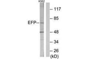 Western blot analysis of extracts from K562 cells, using ZNF147 Antibody. (TRIM25 anticorps  (AA 201-250))