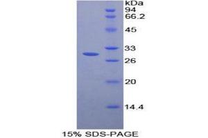 SDS-PAGE (SDS) image for Fc gamma RII (CD32) (AA 47-285) protein (His tag,T7 tag) (ABIN1879160)