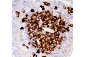 IHC analysis of CD82 using anti-CD82 antibody (ABIN3043486). (CD82 anticorps  (AA 98-267))