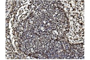 IHC analysis of TET1 using anti TET1 antibody (ABIN7600442). (TET1 anticorps  (AA 194-417))