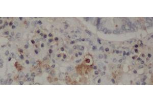 Immunohistochemistry of paraffin-embedded Rat lung using CD68 Polyclonal Antibody at dilution of 1:50