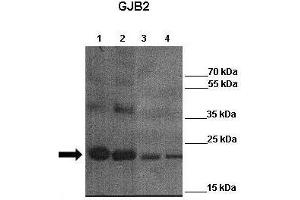 WB Suggested Anti-GJB2 Antibody    Positive Control:  Lane 1: 4ug mCx26 elution fraction 6  Lane 2: 4ug mCx26 elution fraction 7 Lane 3: 4ug mCx26 elution fraction 6 + other Cx26 antibody  Lane 4: 4ug mCx26 elution fraction 7 + other Cx26 antibody   Primary Antibody Dilution :   1:3000  Secondary Antibody :  Anti-rabbit-HRP   Secondry Antibody Dilution :   1:3000  Submitted by:  Juan Zou, Georgia state unviersity (GJB2 anticorps  (Middle Region))