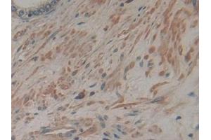 Detection of ATP1b3 in Human Prostate Tissue using Polyclonal Antibody to Sodium/potassium Transporting ATPase Subunit Beta-3 (ATP1b3)