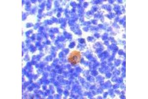 Immunohistochemistry of CARMA1 in mouse thymus with CARMA1 antibody at 10 μg/ml. (CARD11 anticorps)