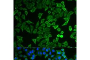 Immunofluorescence analysis of HeLa cells using NPRL2 Polyclonal Antibody (NPRL2 anticorps)