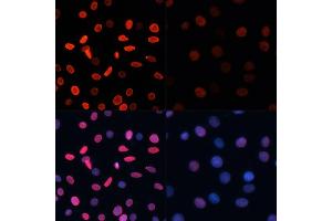 Immunofluorescence analysis of C6 cells using Acetyl-Histone H2B-K5 antibody (ABIN7267733) at dilution of 1:100.