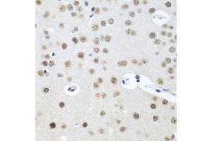 Immunohistochemistry of paraffin-embedded mouse brain using UTP14A antibody at dilution of 1:100 (40x lens). (UTP14A anticorps)