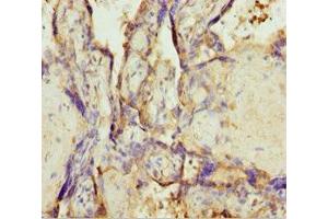 Immunohistochemistry of paraffin-embedded human placenta tissue using ABIN7173219 at dilution of 1:100 (TMEM43 anticorps  (AA 80-310))