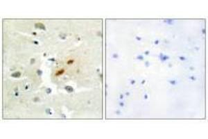 Immunohistochemistry analysis of paraffin-embedded human brain tissue, using DNA Polymerase ζ antibody. (REV3L anticorps)
