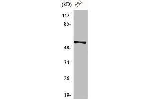 Western Blot analysis of 293 cells using Phospho-Synaptotagmin 1/2 (S309/306) Polyclonal Antibody (SYT1/SYT2 (pSer306), (pSer309) anticorps)