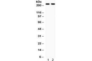 Western blot testing of 1) rat brain and 2) mouse brain lysate with NMDAR2B antibody.