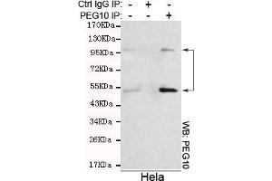 Immunoprecipitation analysis of Hela cell lysates using PEG10 mouse mAb.