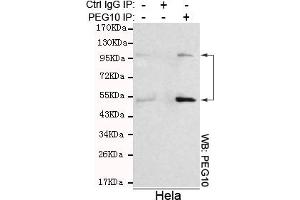 Immunoprecipitation analysis of Hela cell lysates using PEG10 mouse mAb. (PEG10 anticorps)