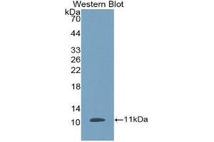 Western blot analysis of the recombinant protein. (beta Defensin 1 anticorps  (AA 24-64))