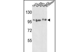 Western blot analysis of ACTN4 Antibody (C-term) (ABIN392219 and ABIN2841915) in T47D, , , HepG2 cell line and mouse bladder tissue lysates (35 μg/lane).