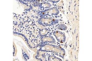 Immunohistochemistry of paraffin embedded mouse duodenum using Cholecystokinin8 (ABIN7073479) at dilution of 1:2000 (400x lens)