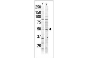 The anti-MST2 Pab (ABIN6243888 and ABIN6579022) is used in Western blot to detect MST2 in Jurkat cell lysate (lane 1) and mouse ovary tissue lysate (lane 2). (STK3 anticorps  (C-Term))
