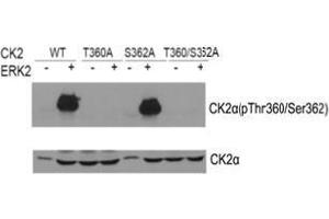 Western blot of CK2α(Phospho-Thr360/Ser362) antibody and CK2αantibody in vitro kinase assay. (CSNK2A1/CK II alpha anticorps  (AA 353-357))