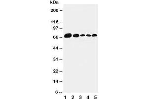Western blot testing of Paxillin antibody and Lane 1:  293T;  2: HeLa;  3: MCF-7;  4: MM231;  5: Jurkat cell lysate